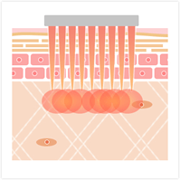 波長：2940nm