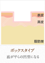 ボックスタイプ：底が平らの凹型になる