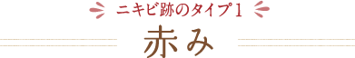 ニキビ跡のタイプ1 赤み